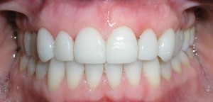 estetica dentale